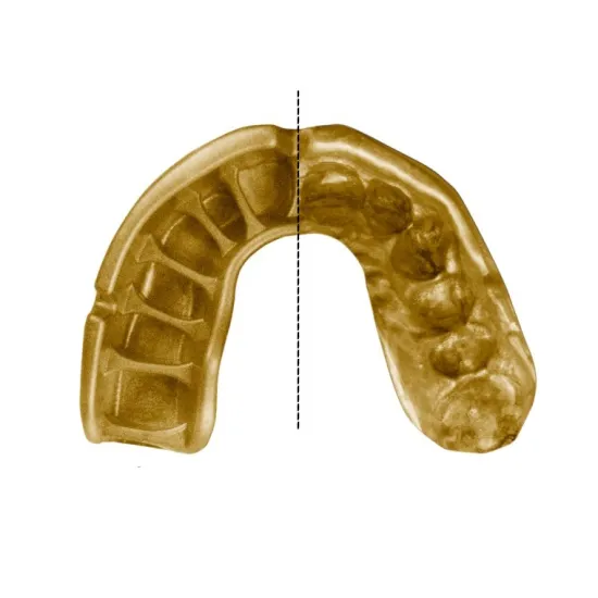 Капа OPRO Gold Grillz Black/Gold-доросла