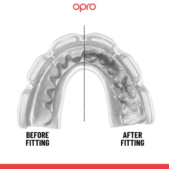 Капа для брекетов OPRO Instant Single Colour Braces Clear-взрослая 